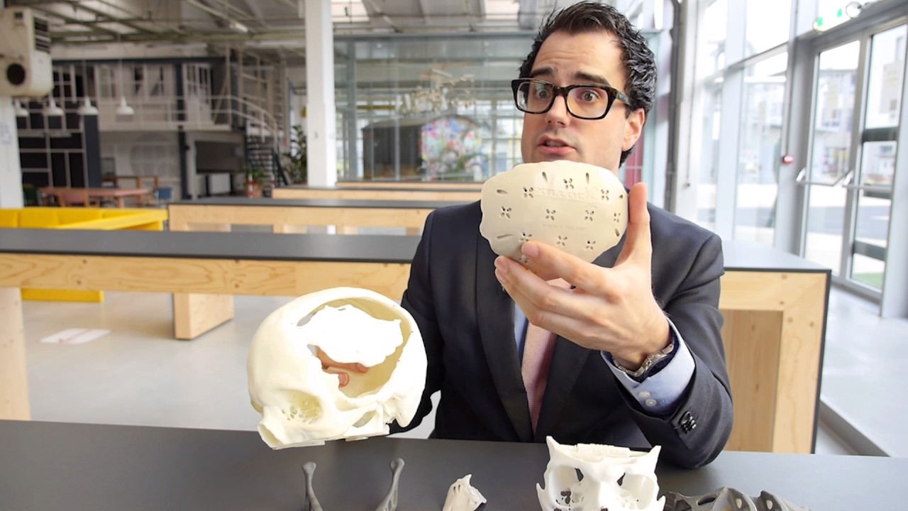 Maikel Beerens (Xilloc): 'Alleen als je doorzet, slaag je in iets'